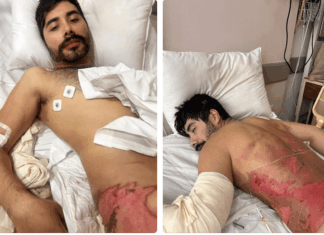 Drag Queens se unen para ayudar a Chuchin, víctima de quemaduras Chuchin is in the Regional Hospital of Puerto Vallarta with second and third degree burns. Photos by Sutton Lee Seymour.